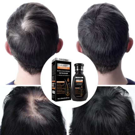 Original Biotin Cold-Pressed DHT BLOCKER Hair Growth Shampoo